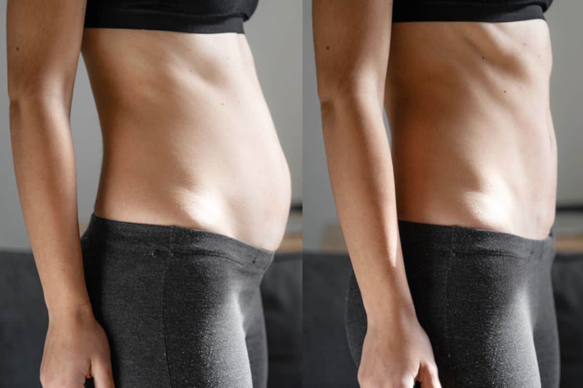 Post-Pregnancy: What Happens to Your Abdominal Muscles After Birth Sunderland