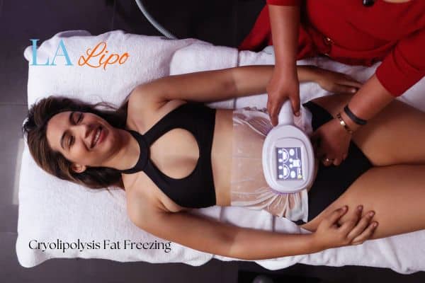 woman getting cryolipolysis Sunderland