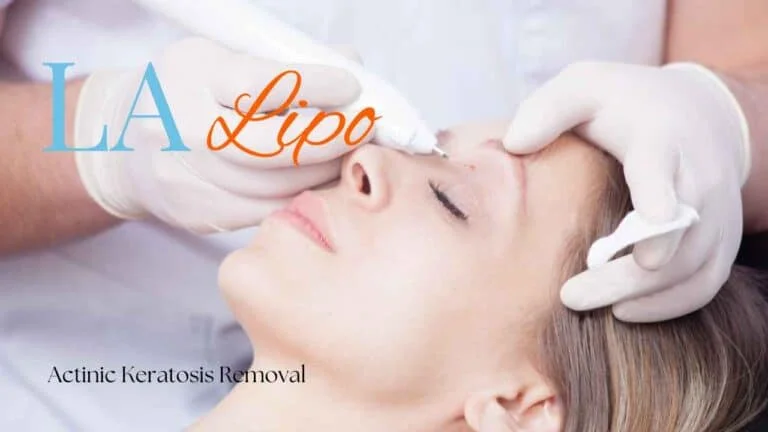 Woman receiving Actinic Keratosis Removal Treatment Sunderland