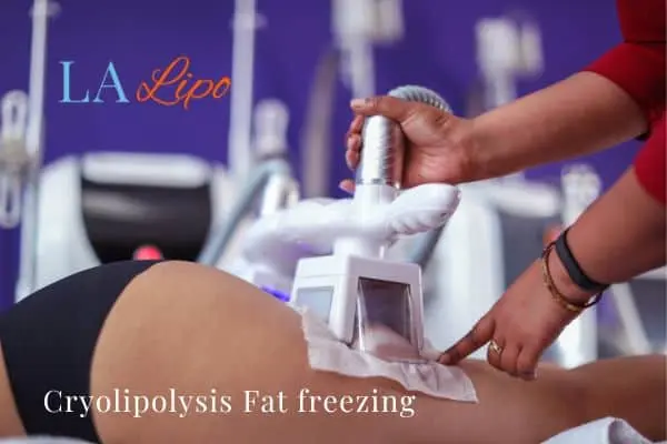 women getting fat freezing Sunderland