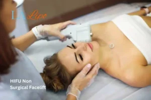 Woman having Hi-Fu to reduce wrinkles Sunderland.