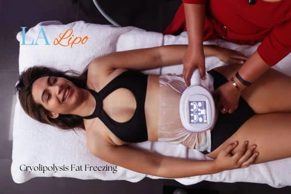 woman getting cryolipolysis Sunderland