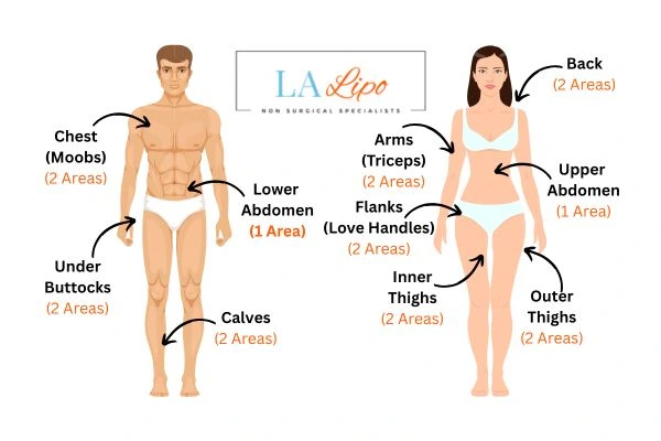 LA LIPO Cryolipolysis Areas Sunderland