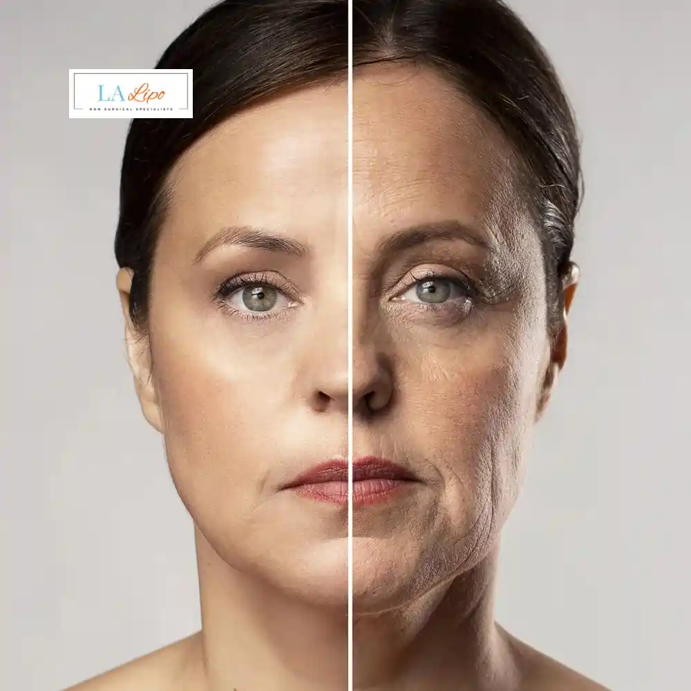 How Can You Tell If Non-Surgical Skin Tightening Is Right for You Sunderland?