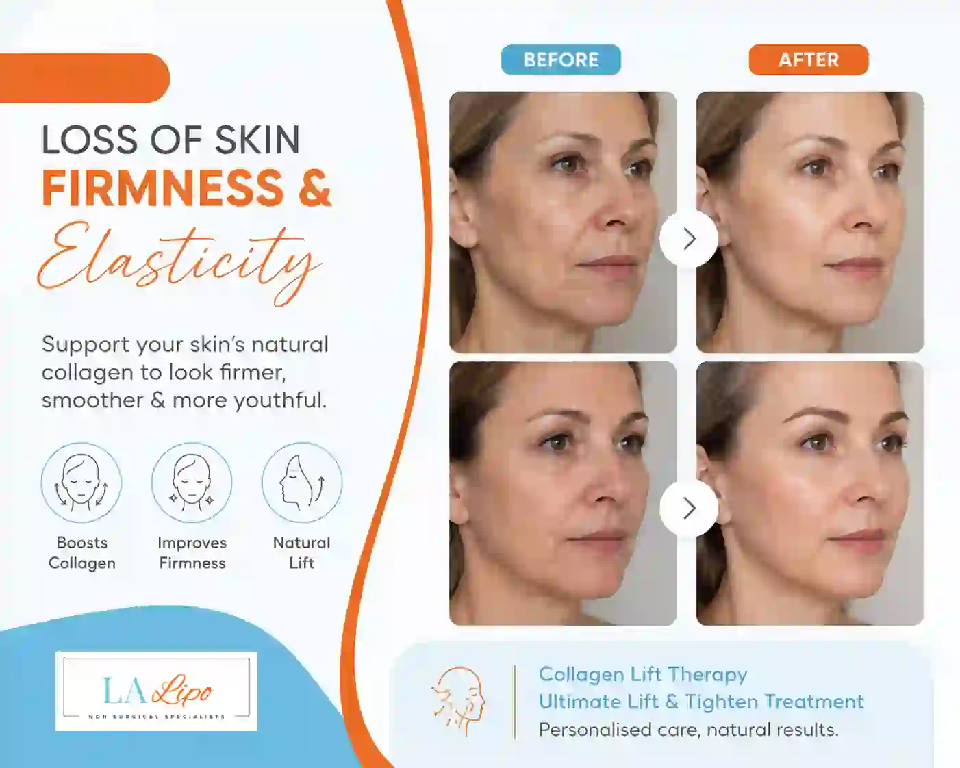 Sign #7: Loss of Skin Firmness and Elasticity Sunderland